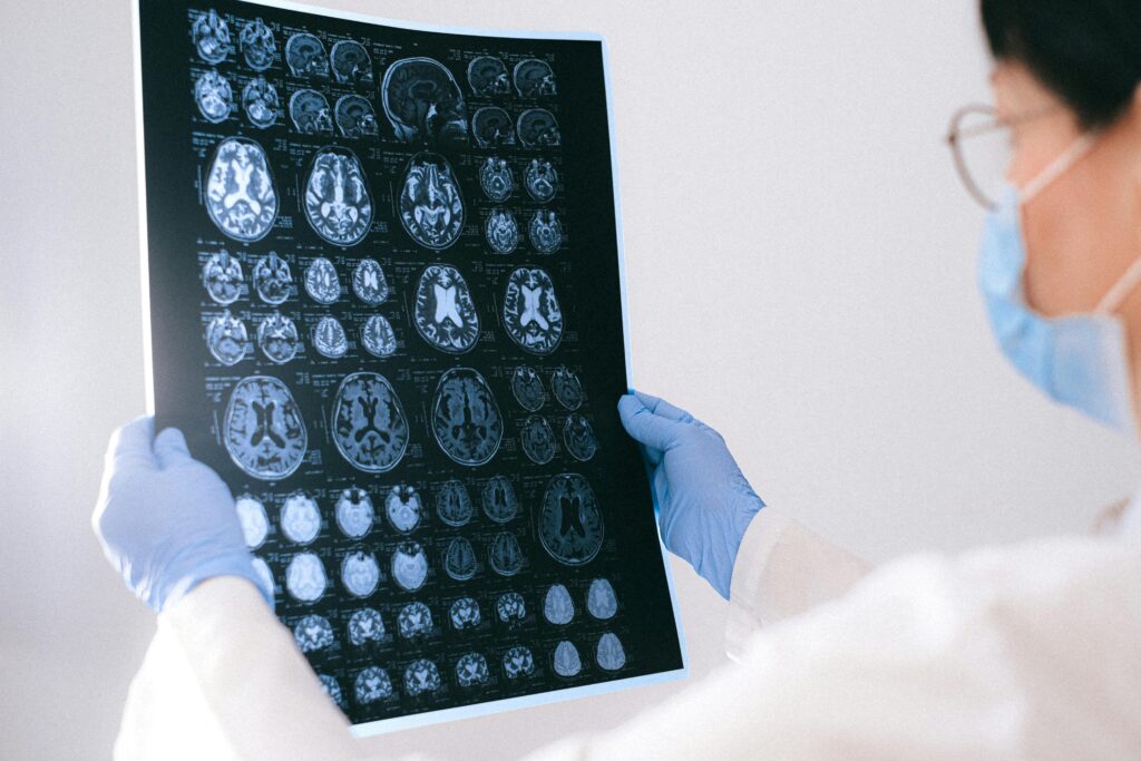 Adderall Neurotoxicity - Alt Text